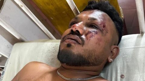 Vishwash Kumar Ramesh, reported by local media to be a survivor of the Air India flight 171 plane crash.