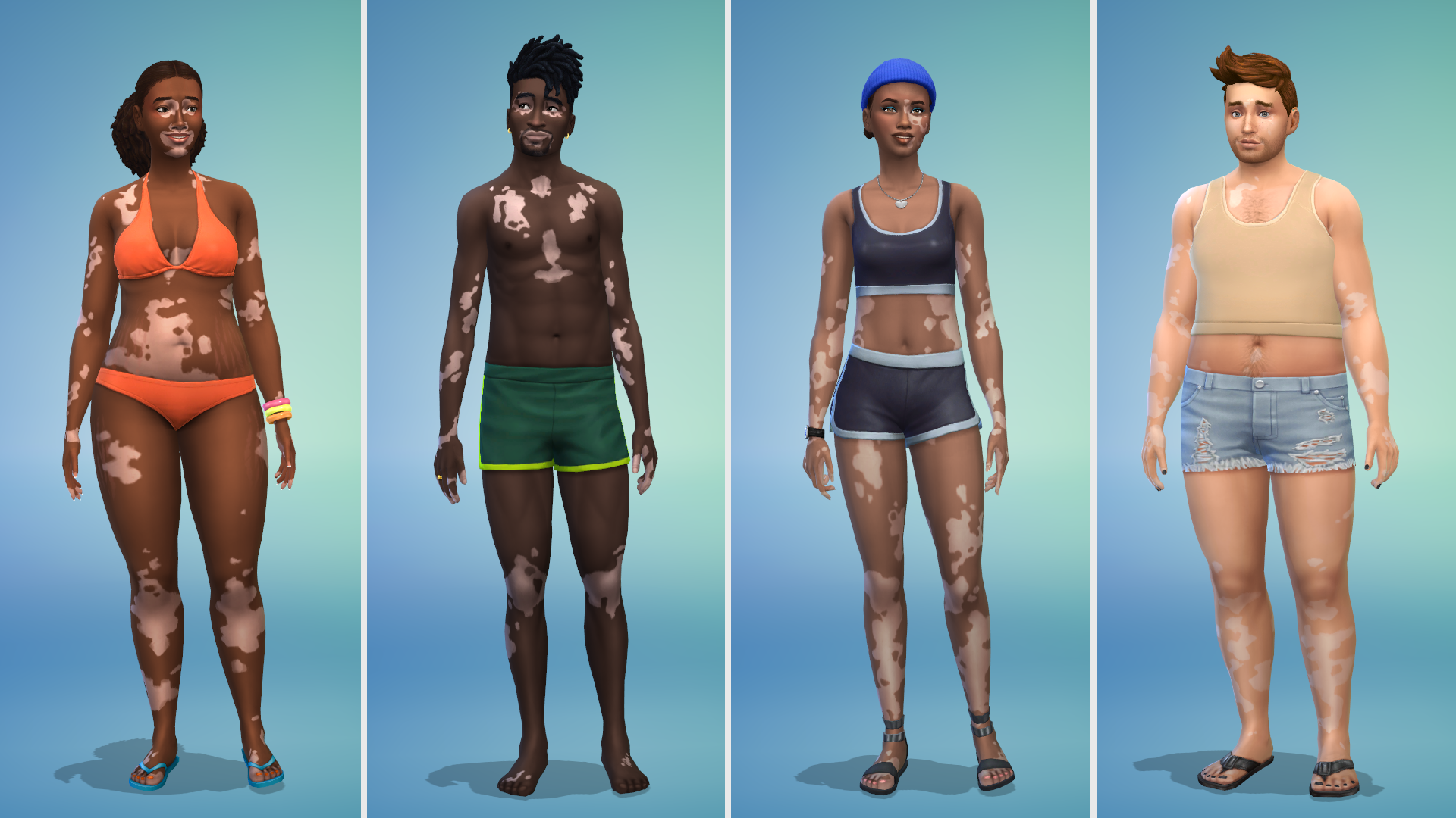 The Sims 4' now lets players add vitiligo skin features to their Sims