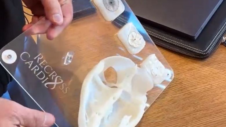 WCVB New Heart Device.JPG