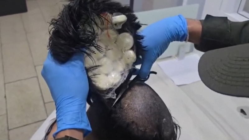 Video: See how much cocaine this man hid under his toupee