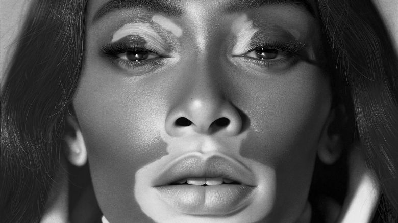 With his new exhibition “Drawing Awareness,” acclaimed British Nigerian hyperrealist artist Kelvin Okafor aims to celebrate different skin conditions. The inspiration for came from his 2019 portrait of fashion model Winnie Harlow, who has the skin condition vitiligo.