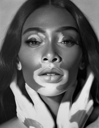 With his new exhibition “Drawing Awareness,” acclaimed British Nigerian hyperrealist artist Kelvin Okafor aims to celebrate different skin conditions. The inspiration for came from his 2019 portrait of fashion model Winnie Harlow, who has the skin condition vitiligo. <strong>Look through the gallery to see more.</strong>