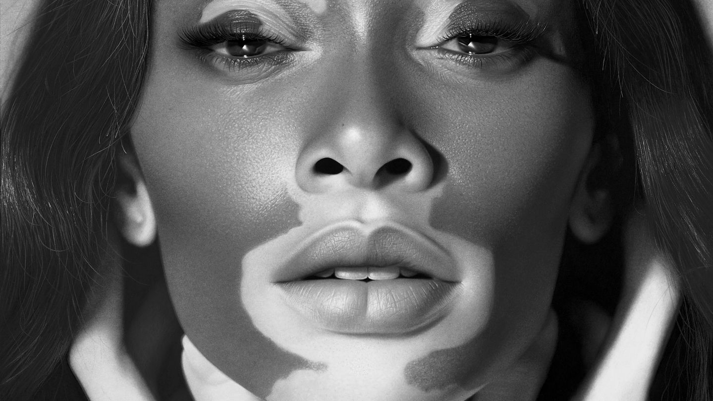 With his new exhibition “Drawing Awareness,” acclaimed British Nigerian hyperrealist artist Kelvin Okafor aims to celebrate different skin conditions. The inspiration for came from his 2019 portrait of fashion model Winnie Harlow, who has the skin condition vitiligo.