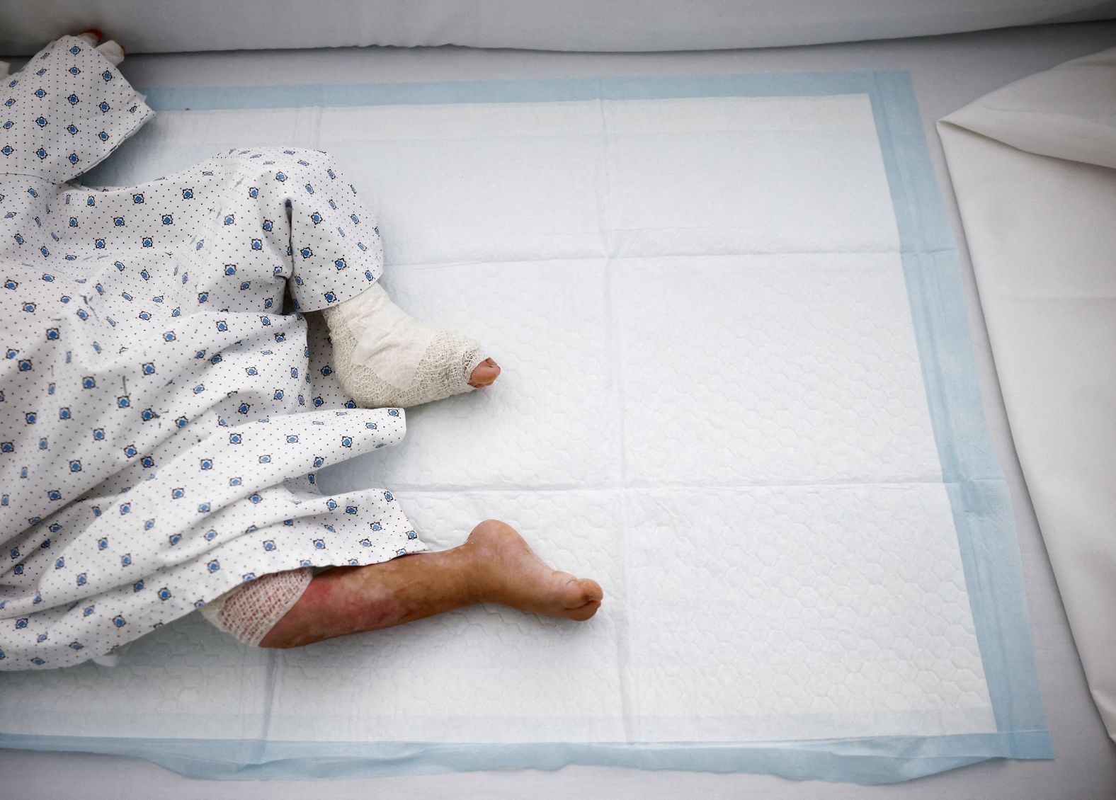 Ivana Skayki, a 2-year-old who suffered third-degree burns over nearly half of her body from an Israeli strike in southern Lebanon, lies in bed at the Geitaoui Hospital in Beirut on Wednesday, October 30. For the past month, Israel has carried out a <a href="index.php?page=&url=https%3A%2F%2Fwww.cnn.com%2F2024%2F10%2F31%2Fmiddleeast%2Fisrael-military-leaders-gaza-lebanon-intl%2Findex.html">massive, countrywide bombing campaign in Lebanon</a> as it targets the Iran-backed militant group Hezbollah.