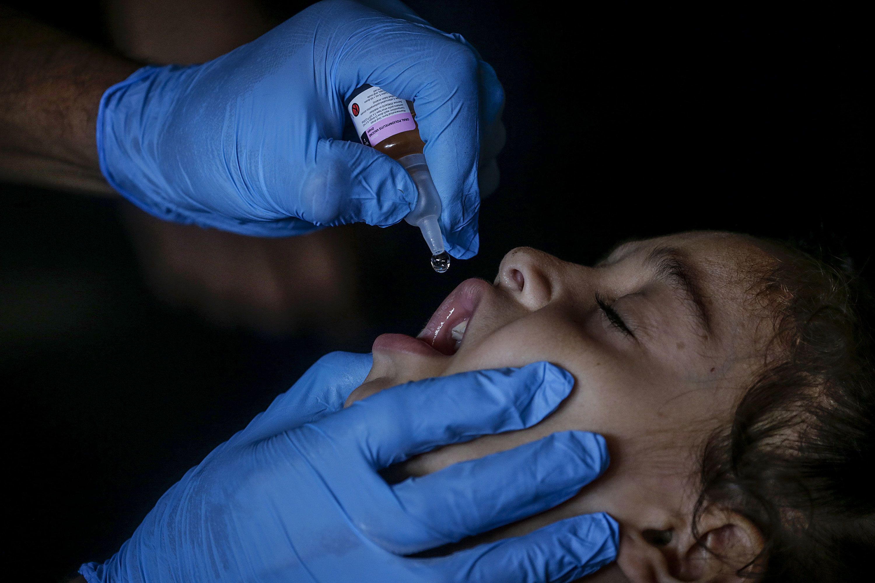 A nurse administers polio vaccine drops in Gaza.