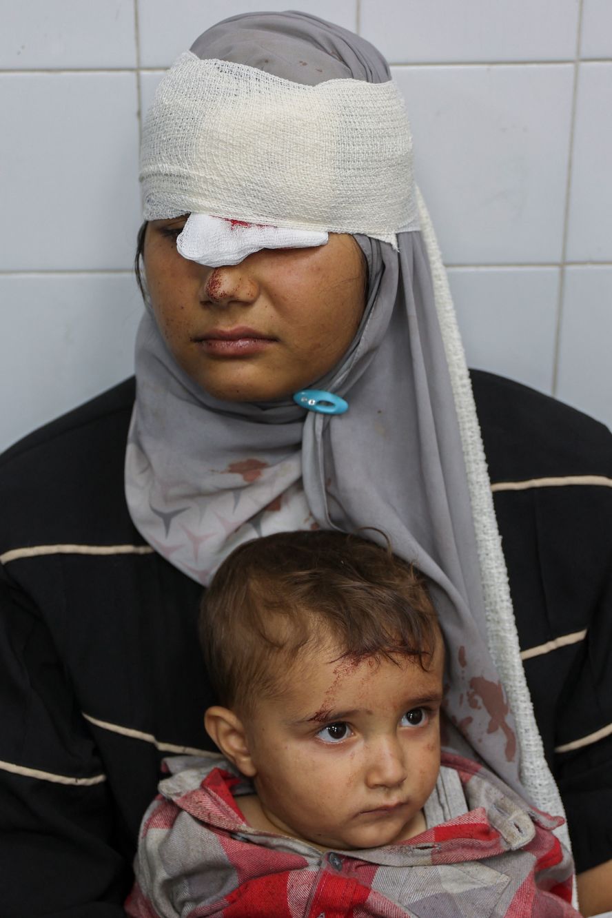 A woman and her child, who were injured during an Israeli operation in the Jabalya refugee camp in Gaza, await treatment at a hospital in Gaza City on Monday, October 21. <a href="index.php?page=&url=https%3A%2F%2Fwww.cnn.com%2Fworld%2Flive-news%2Fisrael-iran-lebanon-gaza-war-10-22-24-intl-hnk%23cm2kvikdh001u3b6ndym4zxeh">An Israeli military operation</a> has been underway at the camp and the surrounding area for more than two weeks now and has killed over 400 Palestinians, according to Gaza Civil Defense.