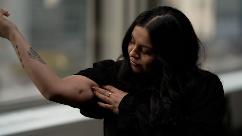 
                            Hear from woman who survived being shot five times by Border Patrol agent in Chicago | CNN