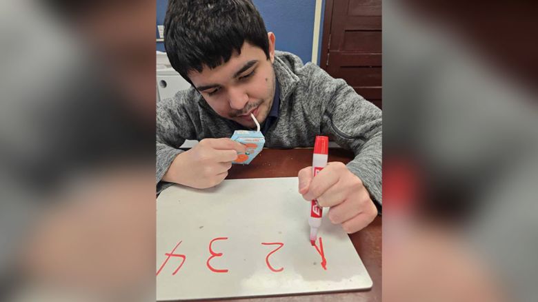 This image provided by Ana Vasquez shows Victor Perez, who was shot after Idaho police officers in Pocatello, Idaho opened fire from behind a chain-link fence on Saturday, April 5, 2025.
