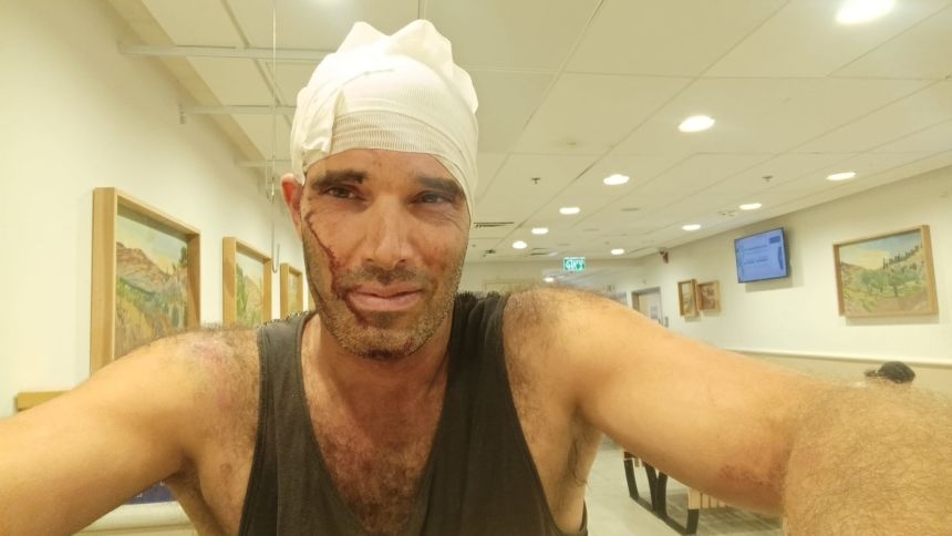 Off-duty Israeli officer Yuval Ben Ali was beaten by dozens of settlers while helping Palestinians harvest olives in the occupied West Bank. He was hospitalized and received four stitches.