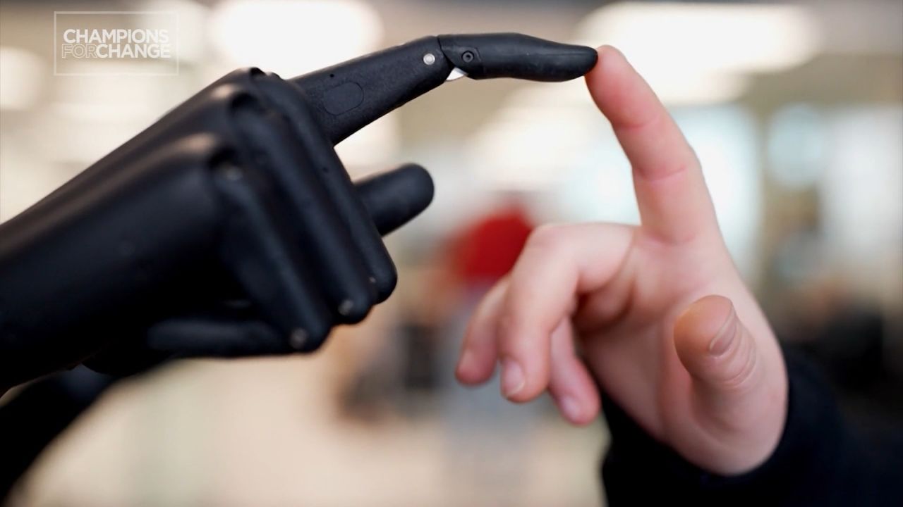 <p>A Ukrainian physician and electronic engineer is working to unlock the future of bionic limbs with the help of AI. Dima Gazda, CEO of Esper Bionics, has created the “Esper Hand” which can detect a patient’s muscle activity, recognize situations and execute motion.</p>