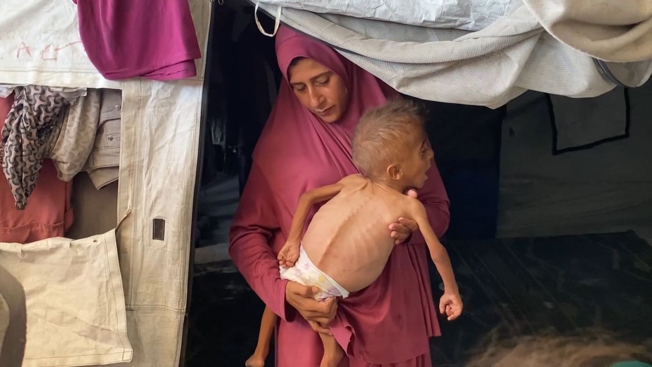 <p>Hospitals in Gaza are working overtime to treat the growing numbers of children experiencing hunger and malnutrition. One of those is 3 year old Mohammed who now weighs only 13 pounds, having rapidly lost six pounds. As Israel agrees to allow airdrops of food aid into the enclave for the first time in months, CNN’s Jeremy Diamond takes a deeper look at the hunger crisis.</p>
