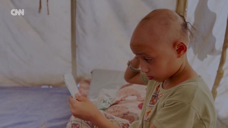 Doctors say war in Gaza led to this child’s hair loss