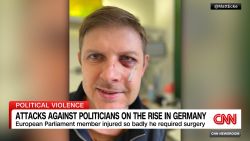 <p>A Berlin city senator has been attacked, in what appears to be an increasing trend of violence against politicians in Germany.  </p>
