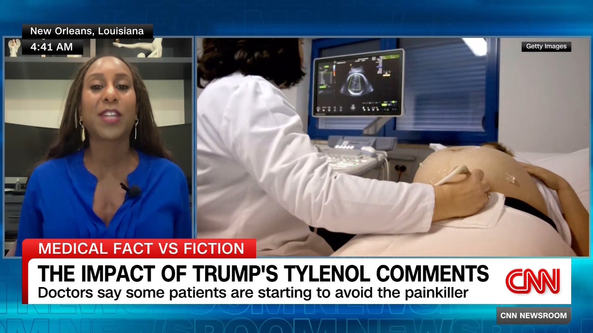 <p>After the Trump administration pushed for a change in policy regarding Tylenol, doctors say they're seeing parents respond. Dr. Veronica Gillespie-Bell, Vice Chair of the ACOG Clinical Practice Guidelines Committee for Obstetrics explains what parents are worried about. </p>
