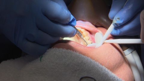 <p>La higiene bucal es importante para una buena salud en general. En el Minuto de Salud de hoy, la Dra. Sasha Ross, periodoncista en la Cleveland Clinic, informa sobre las enfermedades bucales y cómo pueden derivar en distintas padecimientos.</p>